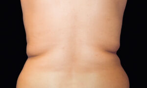 2 before